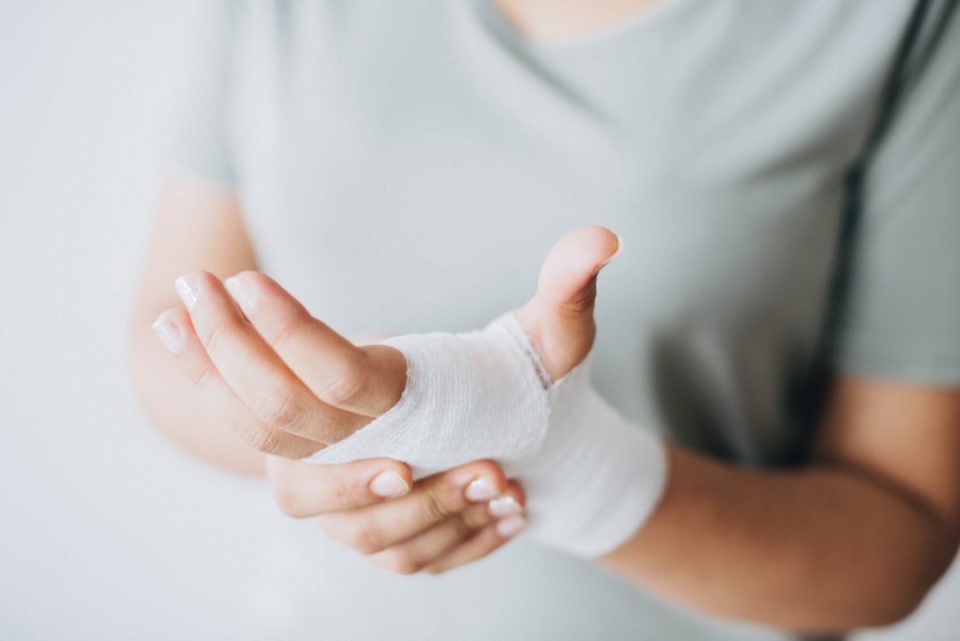 Woman with injured hand